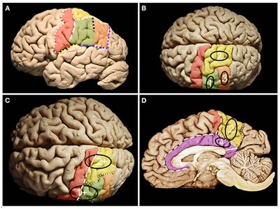 Cortical and Subcortical Anatomy of the Parietal Lobe From the Neurosurgical Perspective